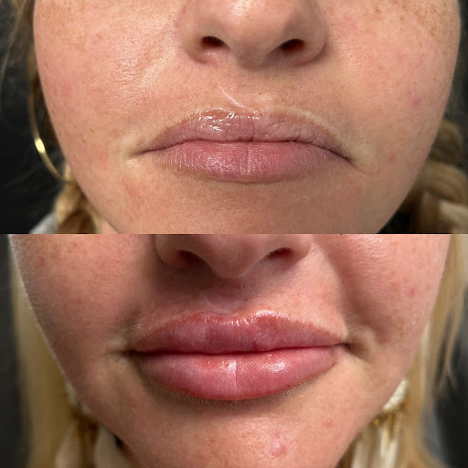 GLO Injector Tabitha at Salon De Christé
