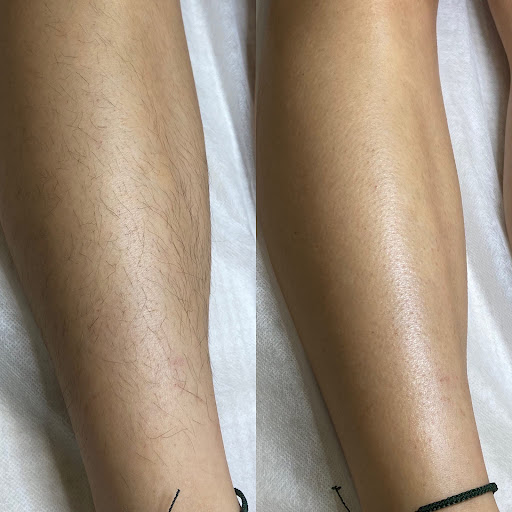 Glos Skin and Wax - Thumbnail