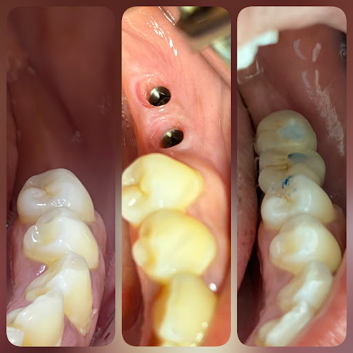 Finding the right solution for missing teeth starts with expert dental care at Shivaay Dental Car… post image