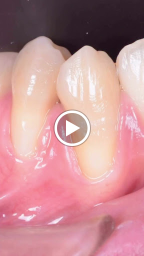 🦷 Healthy Gums, Beautiful Smile | स्वस्थ मसूड़े, खूबसूरत मुस्कान post image
