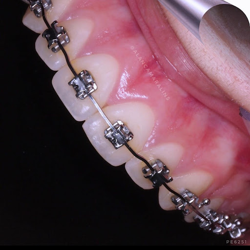 Orthodontic treatment post image