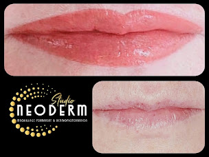 Photo n°18 de STUDIO NEODERM maquillage permanent, microblading & dermopigmentation corrective à Saint-Avé (Clinique de maquillage permanent)