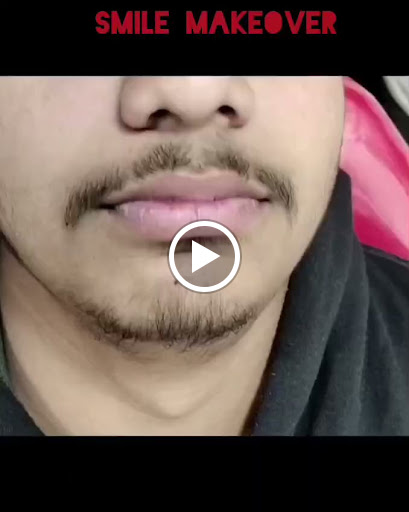 From hiding their smile to showing it off with confidence! post image