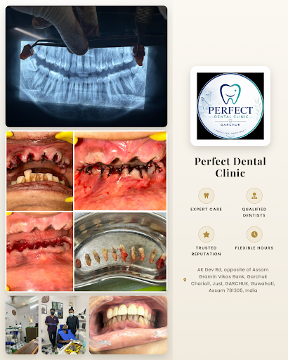 Visit Perfect Dental Clinic for expert dental care including dental bridges, teeth whitening, and… post image