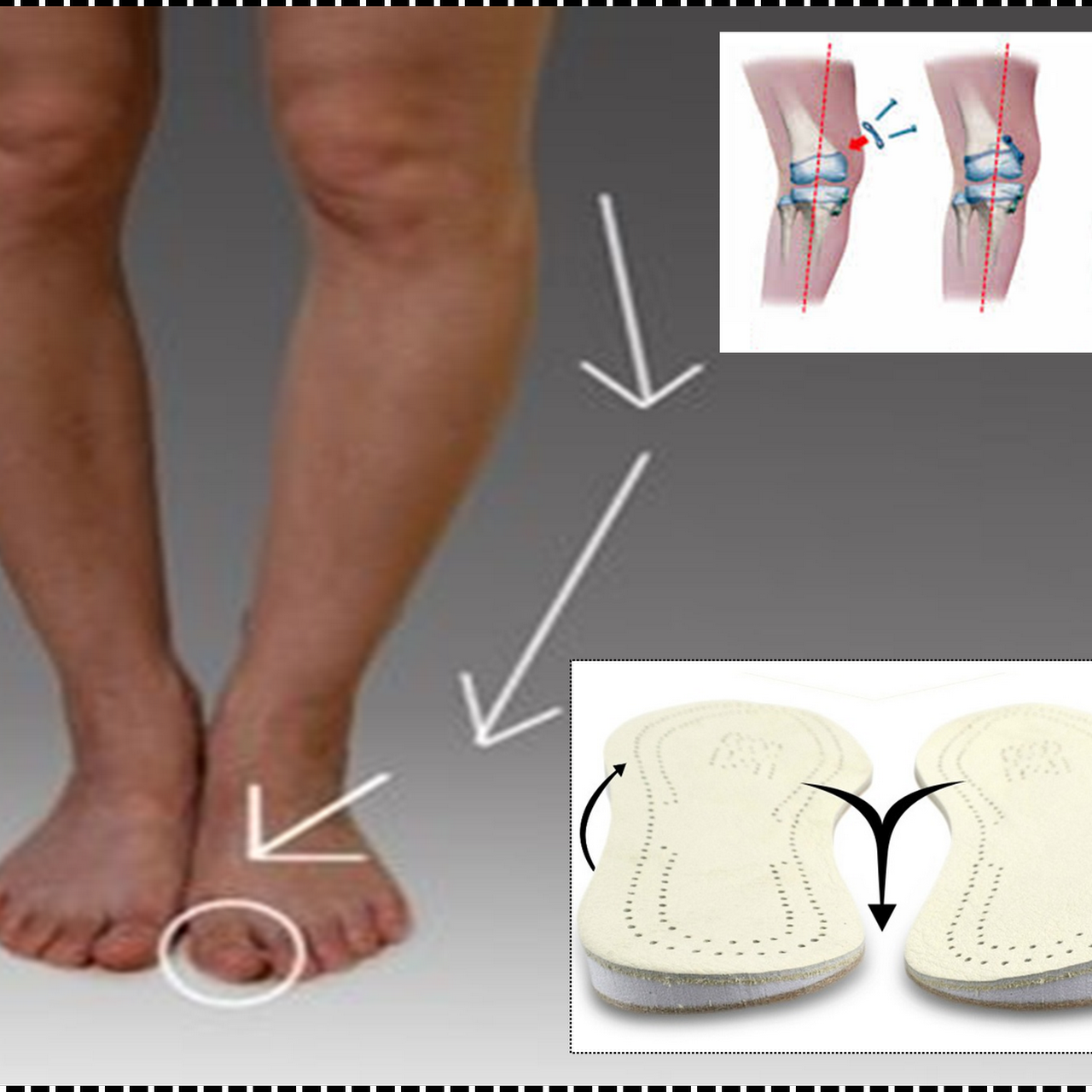 My Care Prosthetics Orthotics Medical Center Orthotics 