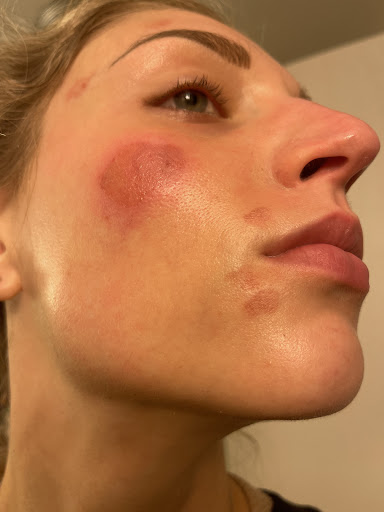 Spa 8:28 - Thumbnail
