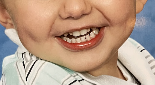 Troy Family Dental PLLC - Thumbnail