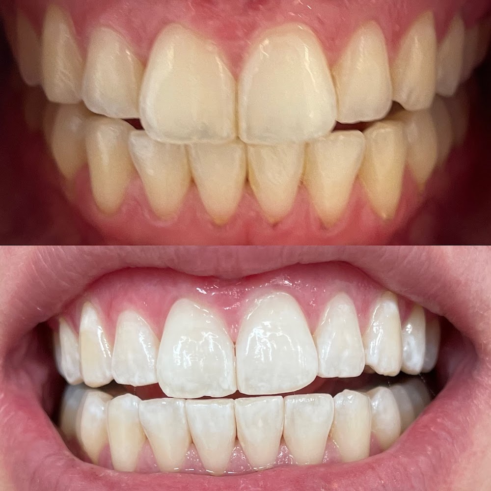 The Whitening Clinic | Waverley