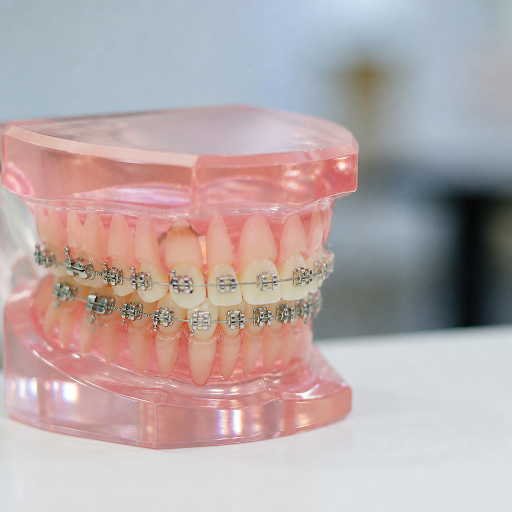 Crooked teeth or an uneven bite can affect chewing, speech, and confidence. At Toothmark Dental c… post image