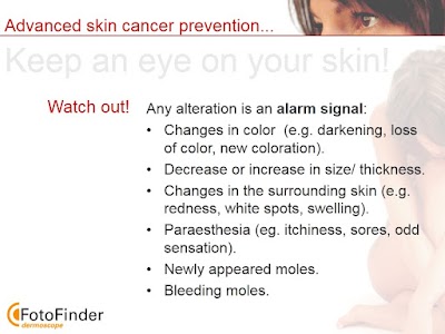 Photos of Dr.Annemie Vander Straeten (Early Detection of Skin Cancer/Mole Mapping)