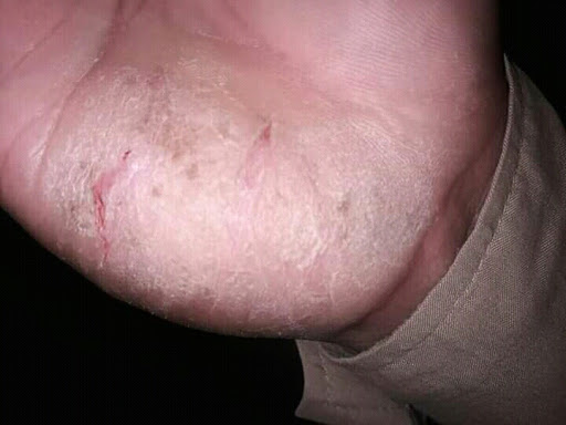 Cured within 2 weeks (Dr Soumya Dey's Clinic desk)  post image