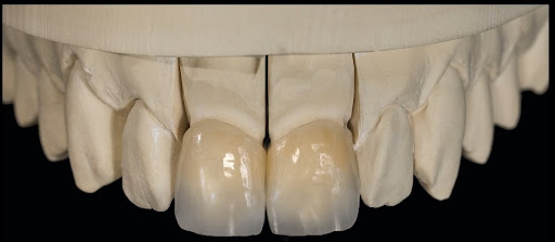 PDL - Pinnacle Dental Laboratory - Thumbnail