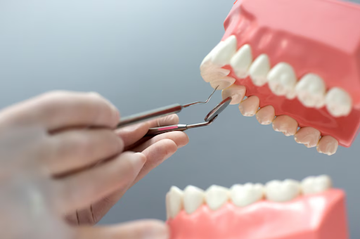 Discover effective strategies for preventing and removing dental plaque and tartar with Dr. Niles…