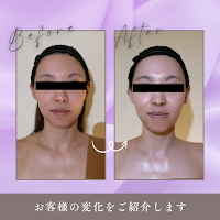 【医師開発4D筋膜リリース】リラクゼーションR安城店