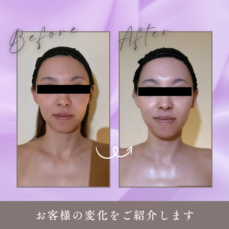 【医師開発4D筋膜リリース】リラクゼーションR安城店