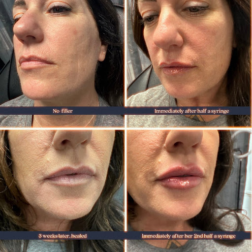 Honest MedSpa - Thumbnail