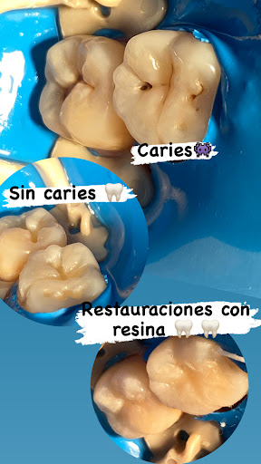 DENTCh / Dentista en Chilapa (odontología integral) - Thumbnail