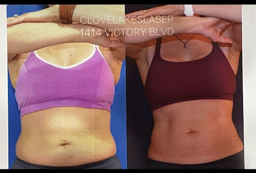 Clove Lakes Laser Center & Medical Spa - Thumbnail