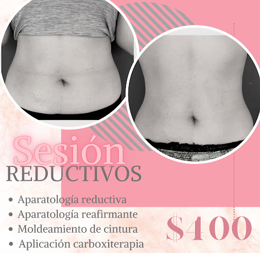 Clinique Herbell Spa. Gallery - Mexico