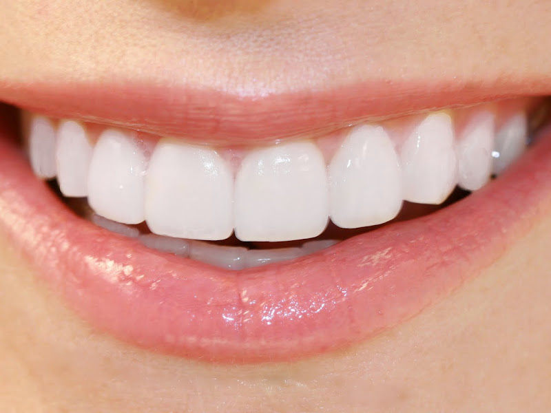 Brunetti Dental photo 2