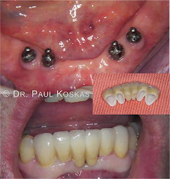 Photo n°13 de Dentiste Argenteuil : Dr. Paul Koskas à Argenteuil (Hygiéniste dentaire)