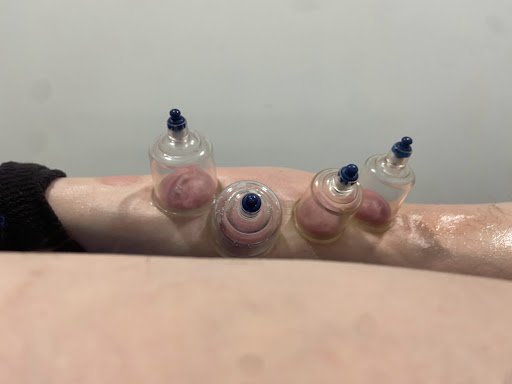 RL Fisioterapia®️ - Thumbnail
