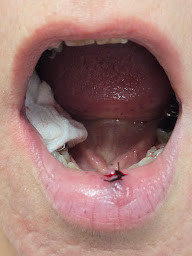 Photo n°17 de Dr Guerrero Natali à Joigny (Orthodontiste)