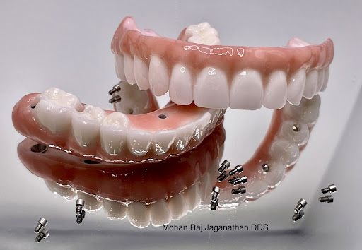 Elite Dental - Mohan Raj Jaganathan DDS & Veena Raja DDS PhD Photo