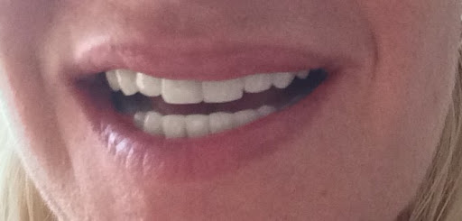 Beautiful Teeth - Praxis moderner Zahnmedizin Voerde | Jens Schönberg - Thumbnail