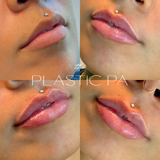 Courtney Moseley - The Plastic PA