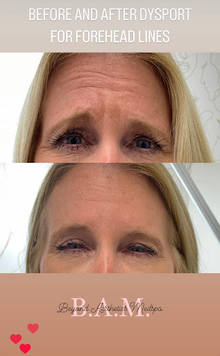 Beyond Aesthetics Medspa (BAM) - Thumbnail
