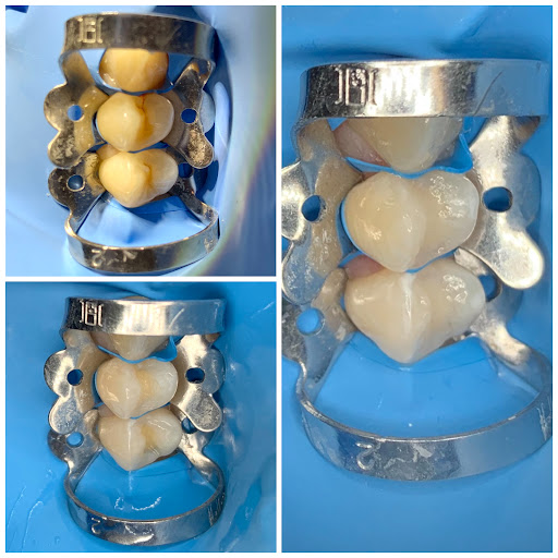 Cirujano dentista Jafet Jiménez (dentaliving) - Thumbnail