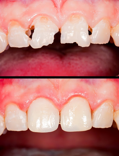 Village Dental - All General, Cosmetic, Implant & Orthodontic Dentistry and Denture Clinic - Thumbnail