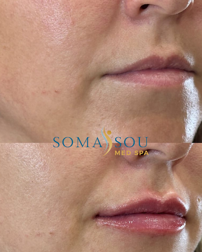 SomaSou MedSpa