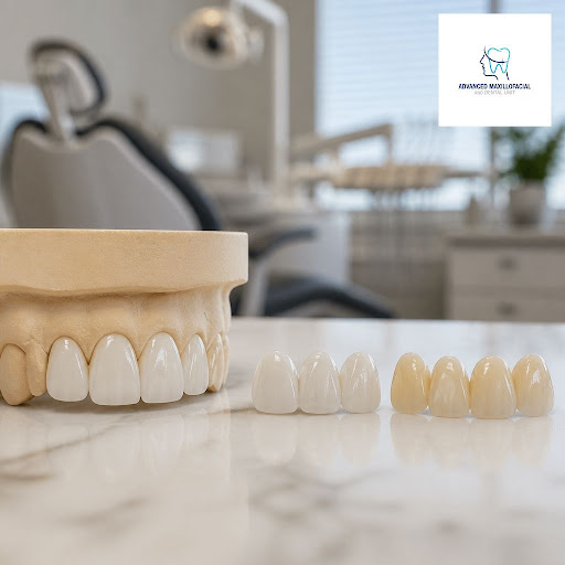 Thinking about a smile makeover but confused between porcelain and composite veneers? At Advanced… post image
