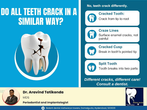 Do All Teeth Crack in a Similar Way? post image