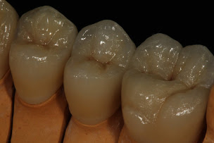 Photo n°2 de Le Sourire Français à Lançon-Provence (Centre de prothèses dentaires)