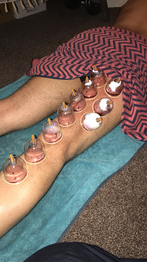 AL Sunnah Hijama Cupping