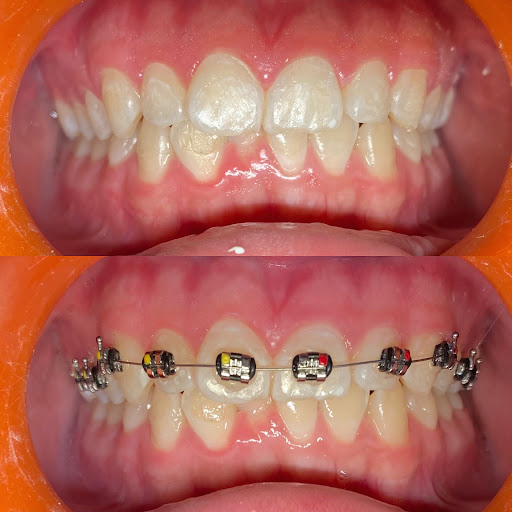 Dentista | Grupo Dental Monterrey