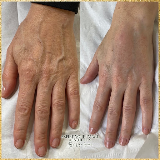 Lisa Kendall | Medical Aesthetics & Wellness