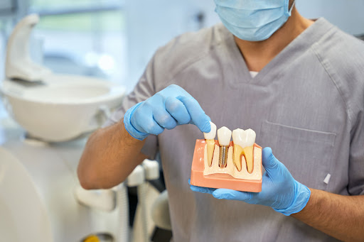 Clínica Dental Casher - Dentista Alicante - Thumbnail