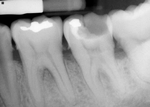 Dentista, odontología general, cosmética dental, implantes ortodoncia - Thumbnail