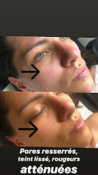 Photo n°16 de EYES SKIN ACADEMY à Saint-Maur-des-Fossés (Institut de beauté)