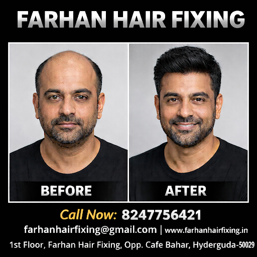 Struggling with hair loss or baldness? Farhan Hair Fixing offers advanced non-surgical hair fixin… post image