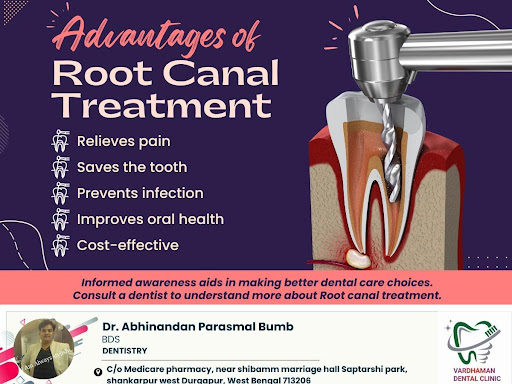 What are the advantages of having a root canal procedure? post image