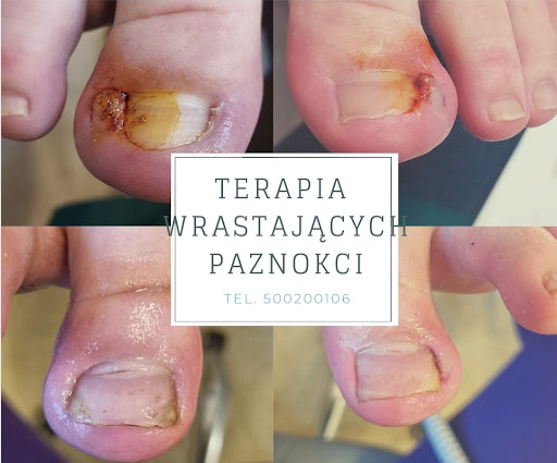 Leczniczy Pedicure / Będzie Pani Zadowolona