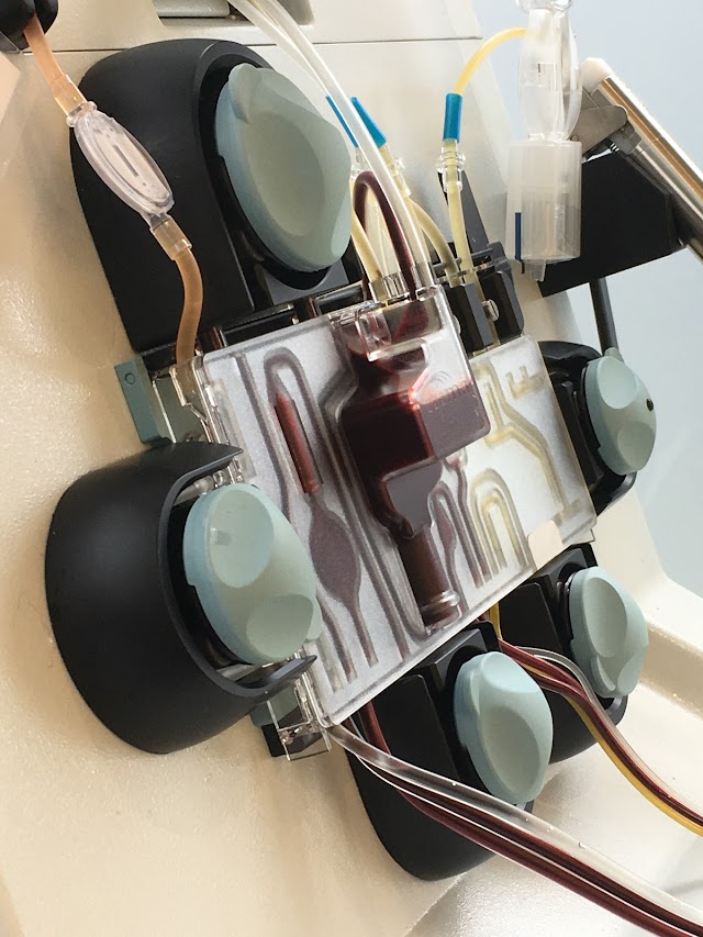 GLOBULE Dix30