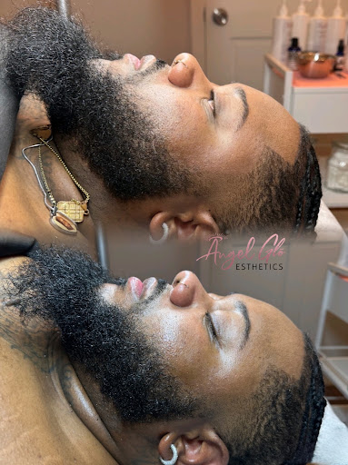 Angel Glō Skincare - Thumbnail
