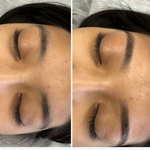 Z beauty - Thumbnail