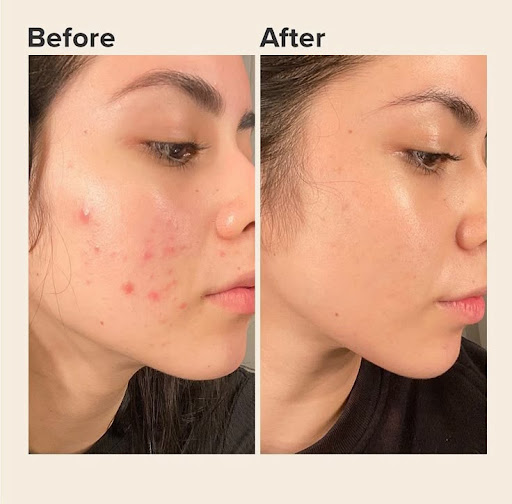 Best Cosmetologist In Mansarovar

#LUMINASKIN&AESTHETICCLINI